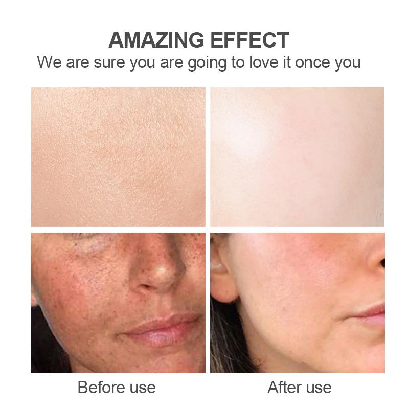 Natürlicher Kojic Gesichtsreiniger / natural kojic face cleanser